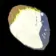 Farosh's Scale